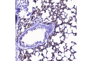 IHC testing of FFPE rat lung with Talin 1 antibody at 2ug/ml. (TLN1 anticorps)