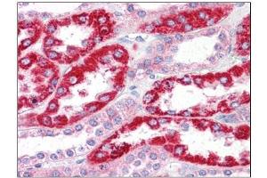 Human Kidney: Formalin-Fixed, Paraffin-Embedded (FFPE) (OCIAD2 anticorps  (N-Term))