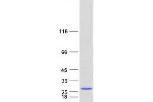 Validation with Western Blot