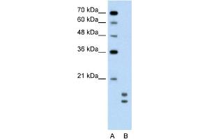 WB Suggested Anti-UBE2L3 Antibody Titration:  0.