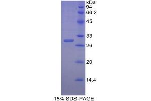 SDS-PAGE of Protein Standard from the Kit (Highly purified E. (CA2 Kit ELISA)