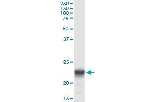 Immunoprecipitation of PMVK transfected lysate using anti-PMVK monoclonal antibody and Protein A Magnetic Bead , and immunoblotted with PMVK MaxPab rabbit polyclonal antibody.