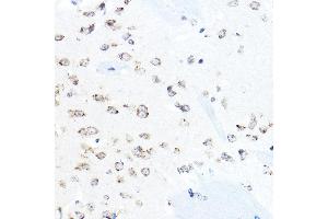 Immunohistochemistry of paraffin-embedded mouse brain using HSP90B1 Rabbit pAb (ABIN6130434, ABIN6142031, ABIN6142033 and ABIN7101795) at dilution of 1:50 (40x lens).