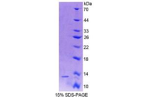 SDS-PAGE (SDS) image for Vitamin D-Binding Protein (GC) (AA 395-475) protein (His tag) (ABIN1171636)