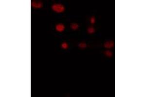 ABIN6274370 staining LOVO cells by IF/ICC.