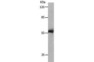 Western Blot analysis of 231 cell using MMP8 Polyclonal Antibody at dilution of 1:800 (MMP8 anticorps)