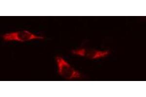 ABIN6274191 staining HeLa cells by IF/ICC. (Hexokinase 1 anticorps  (N-Term))