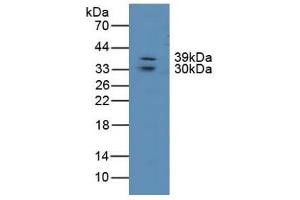 Figure. (LIPG anticorps  (AA 175-412))