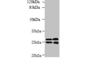 Western blot All lanes: CMBL antibody at 1 μg/mL Lane 1: Mouse kidney tissue Lane 2: Mouse liver tissue Secondary Goat polyclonal to rabbit IgG at 1/10000 dilution Predicted band size: 29 kDa Observed band size: 29, 25 kDa