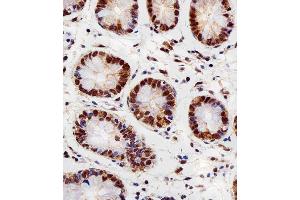 Immunohistochemical analysis of paraffin-embedded H.