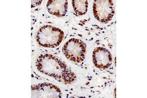 Immunohistochemical analysis of paraffin-embedded H. (RBX1 anticorps  (C-Term))