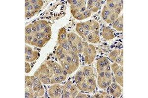 Immunohistochemical analysis of TECR staining in human liver formalin fixed paraffin embedded tissue section. (TECR anticorps  (C-Term))