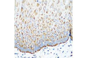 Immunohistochemistry of paraffin-embedded human esophagus using MT-CO2 antibody (ABIN5997496) at dilution of 1/100 (40x lens). (COX2 anticorps)