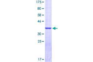 Image no. 1 for Surfactant Protein A1 (SFTPA1) (AA 83-199) protein (GST tag) (ABIN1319776)