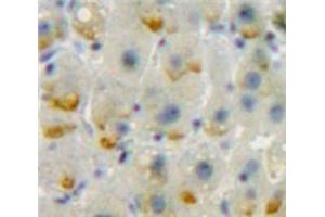Used in DAB staining on fromalin fixed paraffin-embedded Liver tissue (CD86 anticorps  (AA 37-272))
