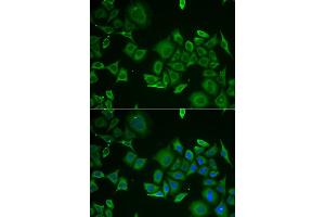 Immunofluorescence analysis of HeLa cell using C1D antibody. (C1D anticorps)