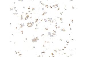 Immunocytochemistry (ICC) image for anti-Mitochondrial Calcium Uniporter (MCU) (AA 300-350) antibody (ABIN7795789)