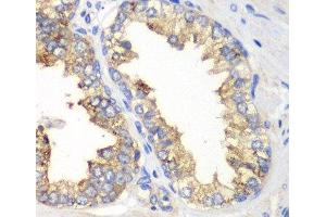 Immunohistochemistry of paraffin-embedded Human prostate using KLK10 Polyclonal Antibody at dilution of 1:100 (40x lens).