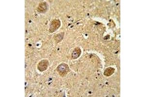 Caspase-3 antibody IHC analysis in formalin fixed and paraffin embedded human brain tissue.