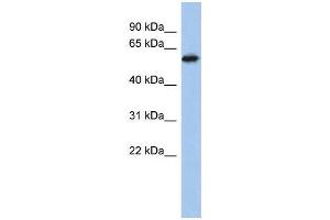 Human PANC1; WB Suggested Anti-ZNF496 Antibody Titration: 0. (ZNF496 anticorps  (Middle Region))