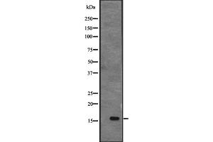 Western blot analysis of CENPS expression in MHF1 transfected 293T cell lysate;,The lane on the left is treated with the antigen-specific peptide.