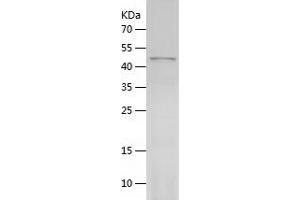 Western Blotting (WB) image for Tubulin, beta 3 (TUBB3) (AA 1-450) protein (His tag) (ABIN7125524)