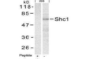 Image no. 3 for anti-SHC (Src Homology 2 Domain Containing) Transforming Protein 1 (SHC1) (Tyr427) antibody (ABIN197590) (SHC1 anticorps  (Tyr427))