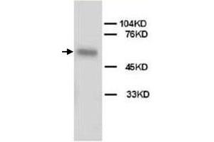 Western Blot analysis of ALPL expression from HeLa cell lyate with ALPL polyclonal antibody . (ALPL anticorps  (N-Term))