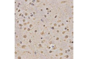 Immunohistochemistry of paraffin-embedded rat brain using MonoMethyl-Histone H3-K36 antibody.