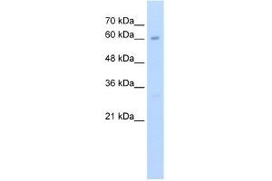 WB Suggested Anti-KIAA0859 Antibody Titration:  2. (METTL13 anticorps  (C-Term))