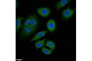Immunofluorescent analysis of A549 cells using ABIN7144908 at dilution of 1:100 and Alexa Fluor 488-congugated AffiniPure Goat Anti-Rabbit IgG(H+L) (ABCC9 anticorps  (AA 560-669))