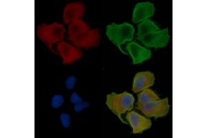 ABIN6260022 and ABIN6276440 staining Hela cells(30 min of UV treatment) by IF/ICC. (ARF6 anticorps  (Internal Region))