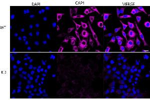 Immunocytochemical staining of HeLa cells using CAP1 antibody (ABIN7797862), 1:1,000), Top panel: wild-type (WT), Bottom panal: CAP1 shRNA knockdown (KD).