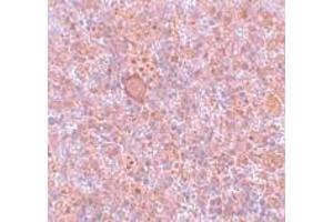 Immunohistochemistry (IHC) image for anti-Retinoblastoma Binding Protein 8 (RBBP8) (Middle Region) antibody (ABIN1031055) (Retinoblastoma Binding Protein 8 anticorps  (Middle Region))