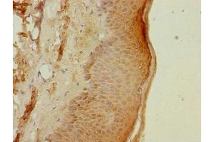Immunohistochemistry of paraffin-embedded human skin tissue using ABIN7164977 at dilution of 1:100 (PSMB3 anticorps  (AA 1-205))
