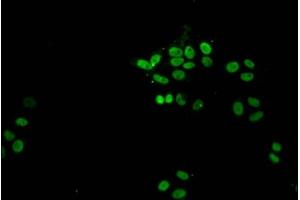 Immunofluorescent analysis of HepG2 cells (sodium butyrate, 30 mM, 4h) using ABIN7139172 at dilution of 1:100 and Alexa Fluor 488-congugated AffiniPure Goat Anti-Rabbit IgG(H+L) (Histone H1.1 anticorps  (acLys21))