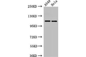 Western Blot Positive WB detected in: A549 whole cell lysate, Hela whole cell lysate All lanes: EPHA5 antibody at 3 μg/mL Secondary Goat polyclonal to rabbit IgG at 1/50000 dilution Predicted band size: 115, 113, 108 kDa Observed band size: 115 kDa (EPH Receptor A5 anticorps  (AA 246-514))