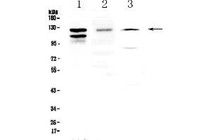 Western blot analysis of VE Cadherin using anti-VE Cadherin antibody . (Cadherin 5 anticorps  (AA 46-285))