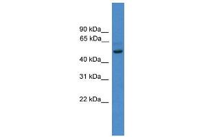 WB Suggested Anti-ZNF277  Antibody Titration: 0. (ZNF277 anticorps  (N-Term))