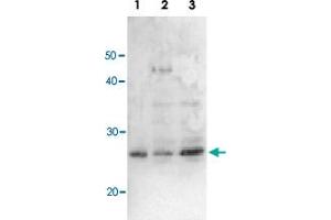 Detection of RuvA (22kD) protein by Western blotting using this antibody. (RuvA anticorps)