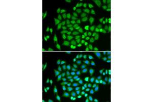 Immunofluorescence analysis of HeLa cells using AKR7A2 antibody. (AKR7A2 anticorps  (AA 100-359))