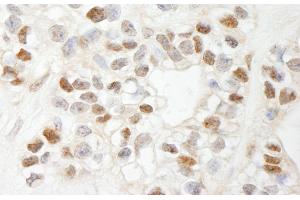 Immunohistochemistry (IHC) image for anti-Chemokine (C-C Motif) Ligand 2 (CCL2) (AA 25-100) antibody (ABIN7449398) (CCL2 anticorps  (AA 25-100))