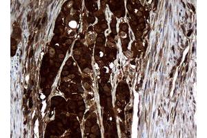 Image no. 3 for anti-Non-Metastatic Cells 1, Protein (NM23A) Expressed in (NME1) antibody (ABIN1499754)