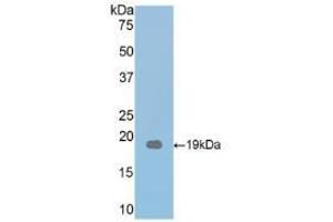 Detection of Recombinant THBS1, Mouse using Polyclonal Antibody to Thrombospondin 1 (THBS1)