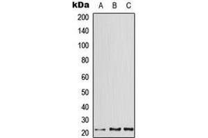 Western blot analysis of ATF3 expression in HeLa (A), mouse heart (B), rat heart (C) whole cell lysates. (ATF3 anticorps  (C-Term))
