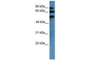 Image no. 1 for anti-Bardet-Biedl Syndrome 2 (BBS2) (AA 315-364) antibody (ABIN6746662) (BBS2 anticorps  (AA 315-364))