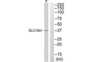 Western blot analysis of extracts from Jurkat cells, using SLC15A1 antibody. (SLC15A1 anticorps  (Internal Region))