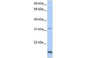 WB Suggested Anti-TCAP Antibody Titration:  0. (TCAP anticorps  (N-Term))