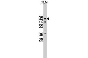 Western blot analysis of CDH10 polyclonal antibody  in CEM cell line lysates (35 ug/lane). (CDH10 anticorps  (N-Term))