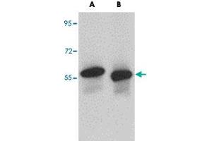 Western blot analysis of SKA3 in human testis tissue lysate with SKA3 polyclonal antibody  at (A) 0. (SKA3 anticorps  (C-Term))